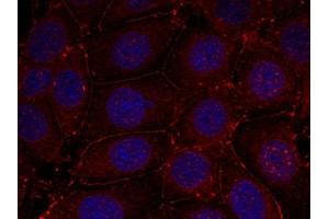 Immunofluorescence staining of methanol-fixed MCF7 cells using IGF-1R (phospho-Tyr1161) antibody. (IGF1R 抗体  (pTyr1161))