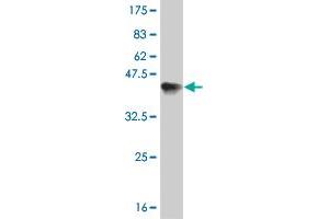 Western Blot detection against Immunogen (36. (ERN1 抗体  (AA 401-500))