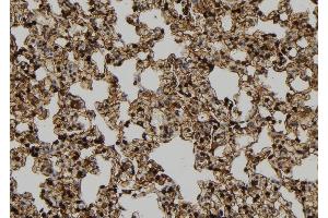 ABIN6278961 at 1/100 staining Rat lung tissue by IHC-P. (Cyclin B2 抗体  (Internal Region))