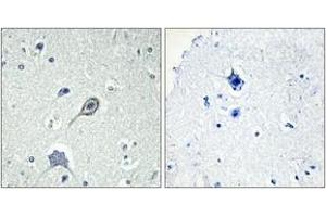 Immunohistochemistry analysis of paraffin-embedded human brain tissue, using CNR1 Antibody. (CNR1 抗体  (AA 151-200))