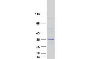 Validation with Western Blot