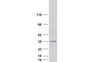 Validation with Western Blot (CNOT7 Protein (Transcript Variant 1) (Myc-DYKDDDDK Tag))