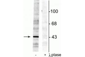 Western blot of rat testes lysate showing specific immunolabeling of the ~46 kDa EphrinB phosphorylated at Tyr298 in the first lane (-). (EPH Receptor B2 抗体  (pTyr298))