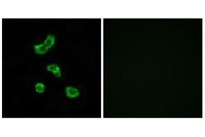 Immunofluorescence analysis of MCF-7 cells, using CA5B antibody. (CA5B 抗体  (C-Term))