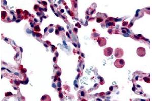 Human Lung, Alveolar Macrophages (formalin-fixed, paraffin-embedded) stained with FFAR2 antibody ABIN213512 at 35 ug/ml followed by biotinylated goat anti-rabbit IgG secondary antibody ABIN481713, alkaline phosphatase-streptavidin and chromogen. (FFAR2 抗体  (Extracellular Domain))