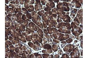 Image no. 7 for anti-Armadillo Repeat Containing 1 (ARMC1) antibody (ABIN1496724)