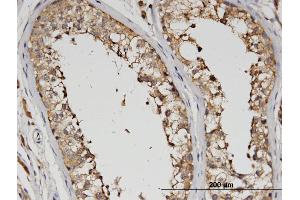 Immunoperoxidase of monoclonal antibody to SLC13A5 on formalin-fixed paraffin-embedded human testis. (SLC13A5 抗体  (AA 152-206))