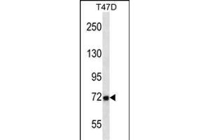 P2 Antibody (Center) (ABIN657616 and ABIN2846612) western blot analysis in T47D cell line lysates (35 μg/lane). (MMP2 抗体  (AA 303-331))