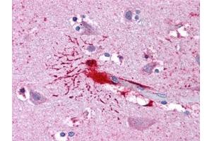 Human Brain, Cortex: Formalin-Fixed, Paraffin-Embedded (FFPE) (LHX8 抗体)