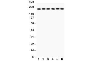 Western blot testing of PAPP-A antibody and human samples 1:  placenta;  2: HT1080;  3: SKOV;  4: 22RV1;  5: SW620;  6: MM231 lysate. (PAPPA 抗体  (AA 95-388))