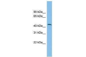 DPH1 antibody used at 1 ug/ml to detect target protein. (DPH1 抗体)