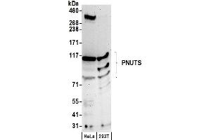 Western Blotting (WB) image for anti-Protein Phosphatase 1, Regulatory (Inhibitor) Subunit 10 (PPP1R10) (C-Term) antibody (ABIN7449565)