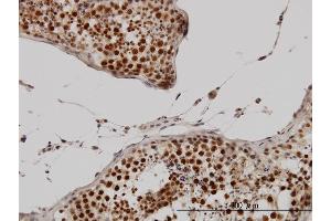 Immunoperoxidase of monoclonal antibody to CCNH on formalin-fixed paraffin-embedded human testis. (Cyclin H 抗体  (AA 1-110))