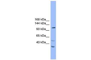 WB Suggested Anti-STARD8 Antibody Titration: 1. (STARD8 抗体  (N-Term))