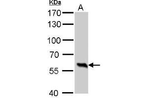Western Blotting (WB) image for anti-Glutamate Decarboxylase 1 (Brain, 67kDa) (GAD1) (N-Term) antibody (ABIN2855214)