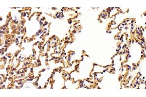 Immunohistochemistry (IHC) image for anti-Angiotensin I Converting Enzyme (Peptidyl-Dipeptidase A) 1 (ACE) (AA 814-1071) antibody (ABIN7430297)