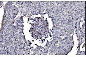 IHC analysis of SLFN11 using anti-SLFN11 antibody (ABIN7599761). (SLFN11 抗体  (AA 114-794))