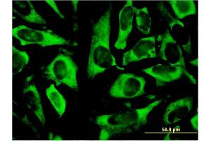 Immunofluorescence of monoclonal antibody to RPLP0 on HeLa cell. (RPLP0 抗体  (AA 1-317))