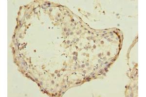 Immunohistochemistry of paraffin-embedded human testis tissue using ABIN7151602 at dilution of 1:100 (ESRG 抗体  (AA 1-222))