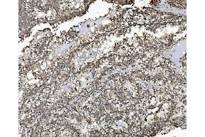 IHC analysis of REA/PHB2 using anti-REA/PHB2 antibody (ABIN7599239). (Prohibitin 2 抗体  (AA 1-299))