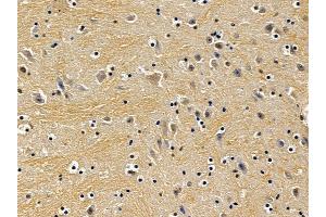ABIN7094042 and ABIN7098086 at 1/100 staining mouse brain tissue by IHC-P. (Exportin 6 抗体  (N-Term))