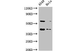 Western Blot Positive WB detected in: A549 whole cell lysate, Hela whole cell lysate All lanes: SMN1 antibody at 2 μg/mL Secondary Goat polyclonal to rabbit IgG at 1/50000 dilution Predicted band size: 32, 29, 31, 28 kDa Observed band size: 40, 60 kDa (SMN1 抗体  (AA 3-194))