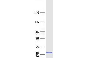 Western Blotting (WB) image for Prefoldin Subunit 6 (PFDN6) protein (Myc-DYKDDDDK Tag) (ABIN2728744)