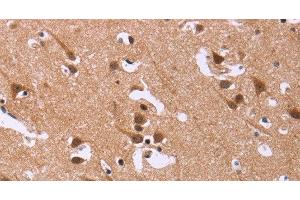 Immunohistochemistry of paraffin-embedded Human brain tissue using DCBLD2 Polyclonal Antibody at dilution 1:50 (DCBLD2 抗体)