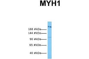Host:  Rabbit  Target Name:  MYH1  Sample Tissue:  Human OVCAR-3  Antibody Dilution:  1. (MYH1 抗体  (N-Term))