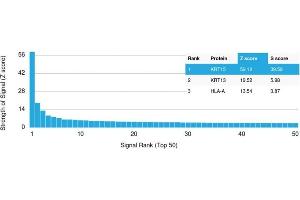 Analysis of Protein Array containing more than 19,000 full-length human proteins using Cytokeratin 15 Mouse Monoclonal Antibody (KRT15/2958). (KRT15 抗体)