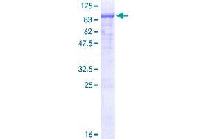EYA4 Protein (AA 1-616) (GST tag)