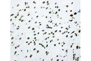 IHC-F testing of SHC antibody and rat brain tissue