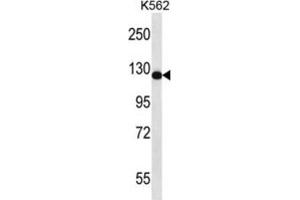 Western Blotting (WB) image for anti-RAS Protein Activator Like 2 (RASAL2) antibody (ABIN2997065) (RASAL2 抗体)
