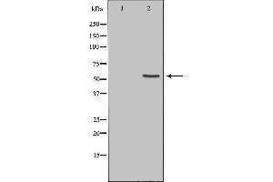 Western blot analysis of extracts from HeLa cells using ETV6 antibody. (ETV6 抗体  (Internal Region))
