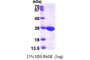 Guanylate Kinase 1 (GUK1) (AA 1-197) protein (His tag)