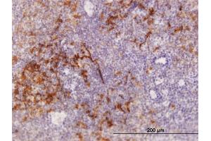 Immunoperoxidase of purified MaxPab antibody to TRAF1 on formalin-fixed paraffin-embedded human tonsil. (TRAF1 抗体  (AA 1-416))