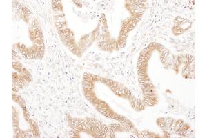 Immunohistochemistry (IHC) image for anti-Ribophorin II (RPN2) (AA 350-400) antibody (ABIN7455016) (Ribophorin II 抗体  (AA 350-400))