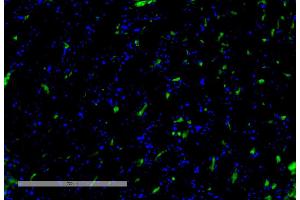 Immunohistochemistry analysis using Mouse Anti-VPS35 Monoclonal Antibody, Clone 8A3 (ABIN6932975). (VPS35 抗体  (HRP))