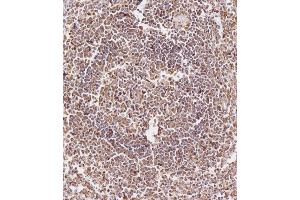 Immunohistochemical analysis of (ABIN657900 and ABIN2846851) on paraffin-embedded Human spleen tissue. (CD163L1 抗体  (C-Term))