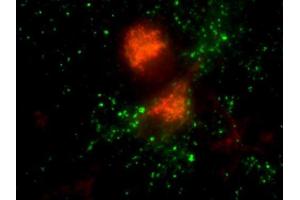 Immunofluorescence labeling of cultured hippocampal neurons with anti-vti1b (red; dilution 1 : 1000) and anti-synaptophysin (green; cat.