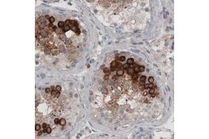 Immunohistochemical staining (Formalin-fixed paraffin-embedded sections) of human testis with LY6K monoclonal antibody, clone CL2435  shows strong cytoplasmic immunoreactivity in a subset of cells in seminiferous tubules. (Ly6k 抗体)