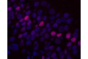 Immunofluorescence analysis of paraffin-embedded rat brain using c-Fos Monoclonal Antibody at dilution of 1:400. (c-FOS 抗体)