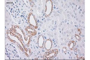 Immunohistochemical staining of paraffin-embedded Kidney tissue using anti-KRT19mouse monoclonal antibody. (Cytokeratin 19 抗体  (AA 240-390))