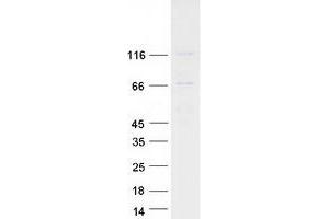 Western Blotting (WB) image for Ellis Van Creveld Syndrome (EVC) protein (Myc-DYKDDDDK Tag) (ABIN2720591)