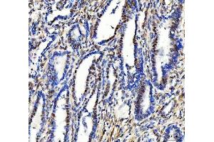 IHC analysis of Aurora A/AURKA using anti-Aurora A/AURKA antibody (ABIN7600751).