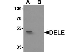 Western blot analysis of DELE in rat brain tissue lysate with DELE antibody at 1 µg/mL in (A) the absence and (B) the presence of blocking peptide.