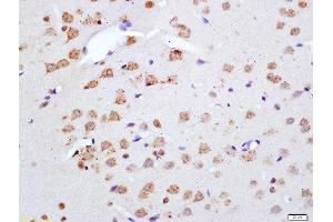 Formalin-fixed and paraffin embedded rat brain labeled with Anti-Phospho-Merlin(Ser518) Polyclonal Antibody, Unconjugated  at 1:200 followed by conjugation to the secondary antibody and DAB staining