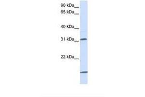 Image no. 1 for anti-Solute Carrier Family 25 (Mitochondrial Carrier, Oxoglutarate Carrier), Member 11 (SLC25A11) (N-Term) antibody (ABIN6738098)