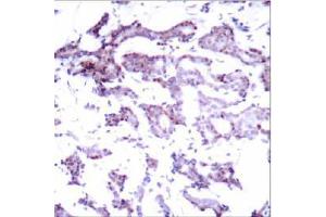 Image no. 1 for anti-ELK1, Member of ETS Oncogene Family (ELK1) (Ser389) antibody (ABIN197160) (ELK1 抗体  (Ser389))