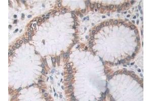 Detection of PAR4 in Human Stomach Tissue using Polyclonal Antibody to Protease Activated Receptor 4 (PAR4)